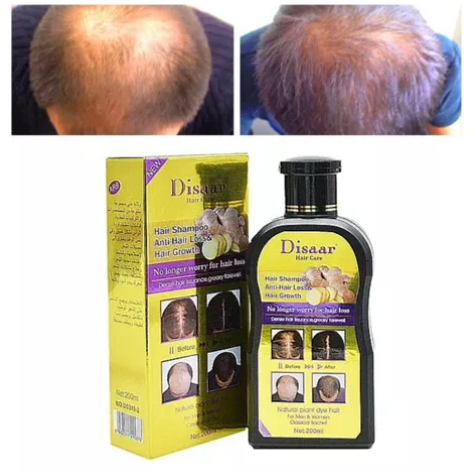 SHAMPOO ANTICAIDA ORGANICO JENGIBRE